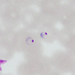 Case377_E.jpg
