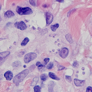 Case378_B.jpg