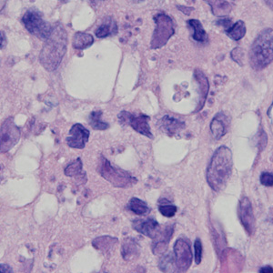 Case378_C.jpg