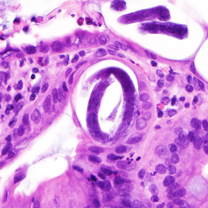 Case380_C.jpg