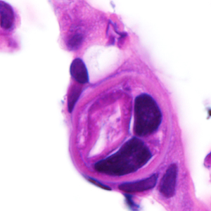 Case380_E.jpg