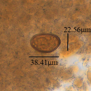 Case381_B.jpg