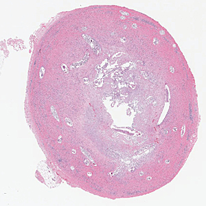 November - 2014 - Case #384
