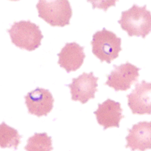 Case385_B.jpg