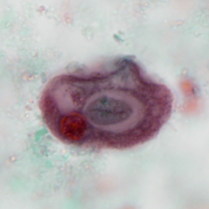 Case386_F.jpg