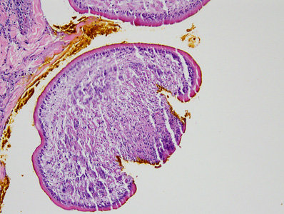 Case387_B.jpg