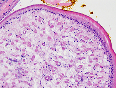 Case387_D.jpg