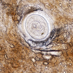 Case389_B.jpg