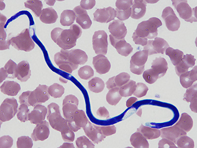 Case390_B.jpg