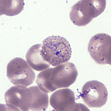 March - 2015 - Case #392