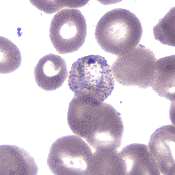 Case392_C.jpg