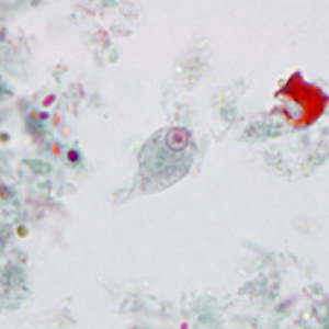 Case395_B.jpg
