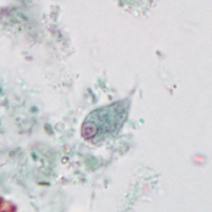 Case395_C.jpg