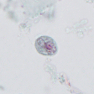 Case395_D.jpg