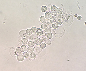 May - 2015 - Case #396