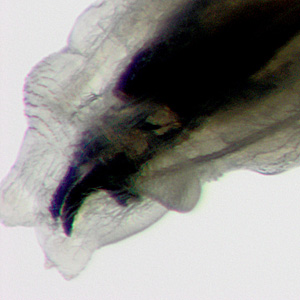 Case397_B.jpg