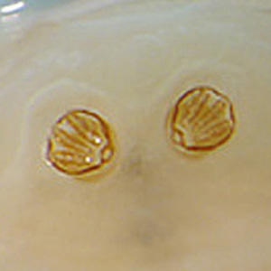 Case397_D.jpg