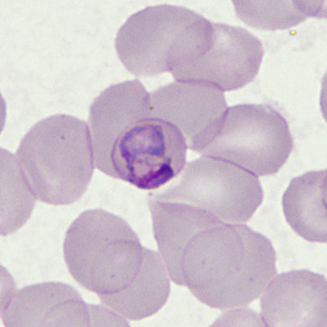Case398_E.jpg