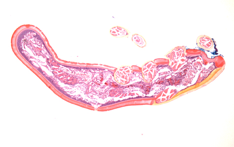 July - 2015 - Case #399