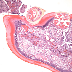 Case399_C.jpg