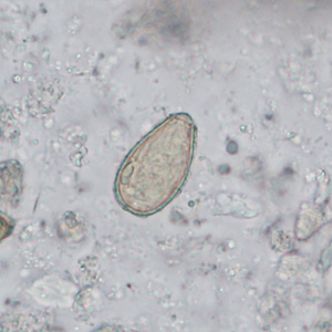 Case402_C.jpg