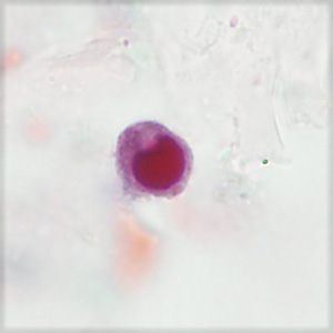 Case406_D.jpg