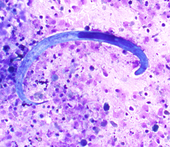 Case407_B.jpg
