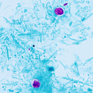 Case409_B.jpg