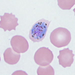 Case410_C.jpg