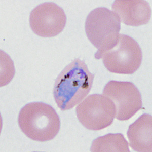 Case410_F.jpg