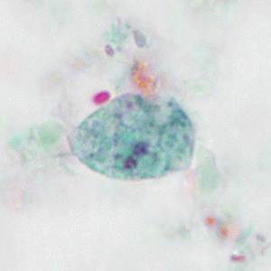 Case414_D.jpg