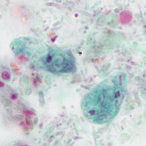 Case414_E.jpg