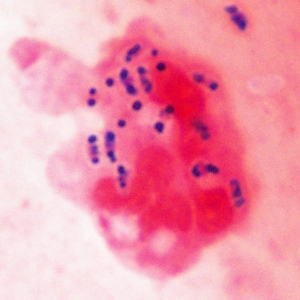 March - 2016 - Case #415