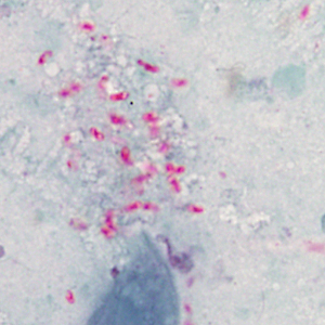 Case415_C.jpg