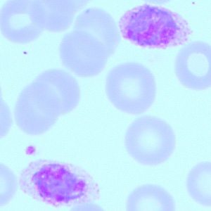 Case418_B.jpg