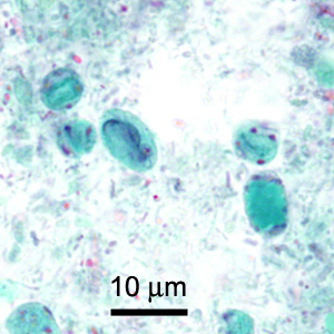 Case419_C.jpg