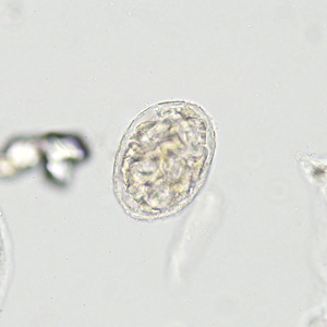 Case422_B.jpg