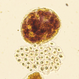 Case422_E.jpg