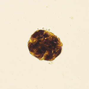 Case422_F.jpg