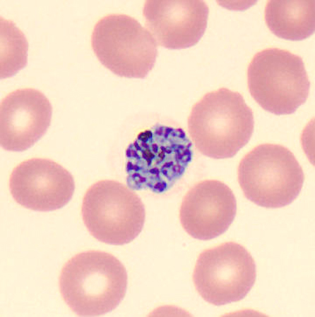 Case424_C.jpg