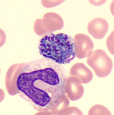 Case424_F.jpg