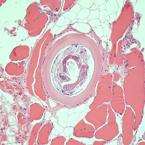 Case426_C.jpg