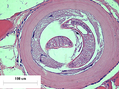 Case426_E.jpg