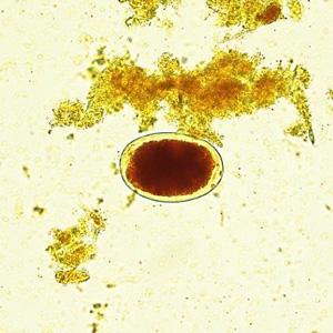 September - 2016 - Case #427