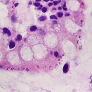 Case428_B.jpg