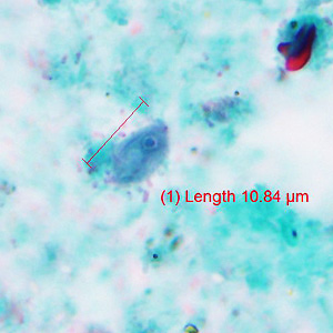 Case429_A.jpg