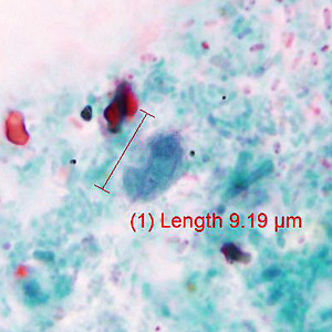 Case429_B.jpg