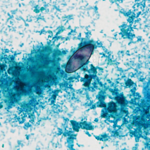Case430_B.jpg