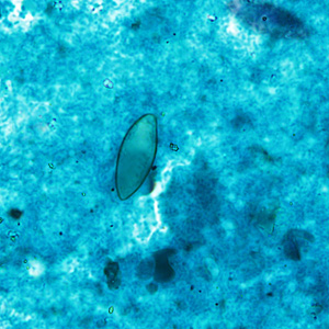 Case430_C.jpg