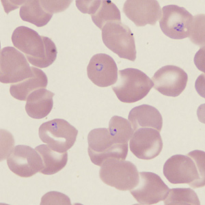 November - 2016 - Case #431